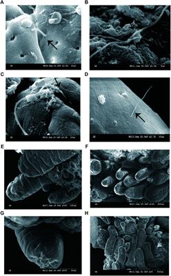 Adhesive Bacteria in the Terminal Ileum of Children Correlates With Increasing Th17 Cell Activation